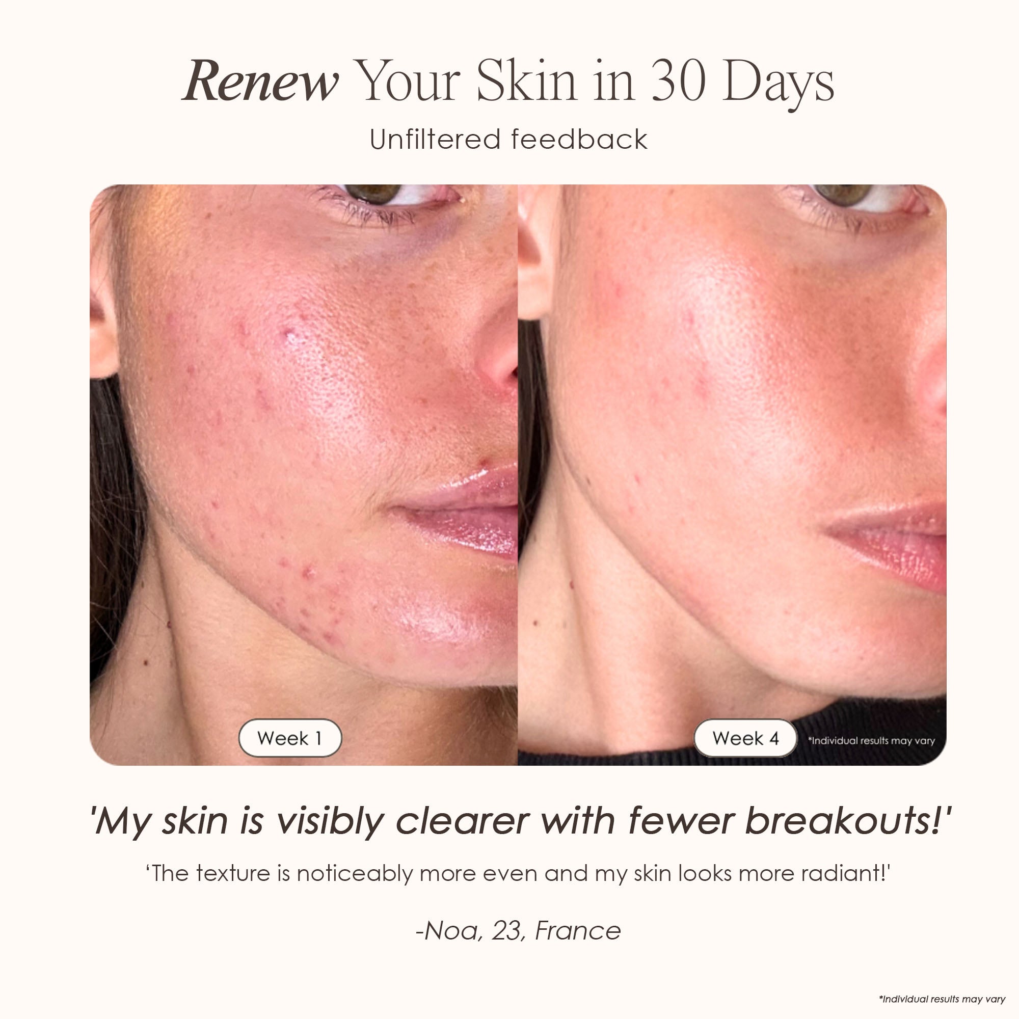 visible results after 4 weeks of using the LED light therapy mask