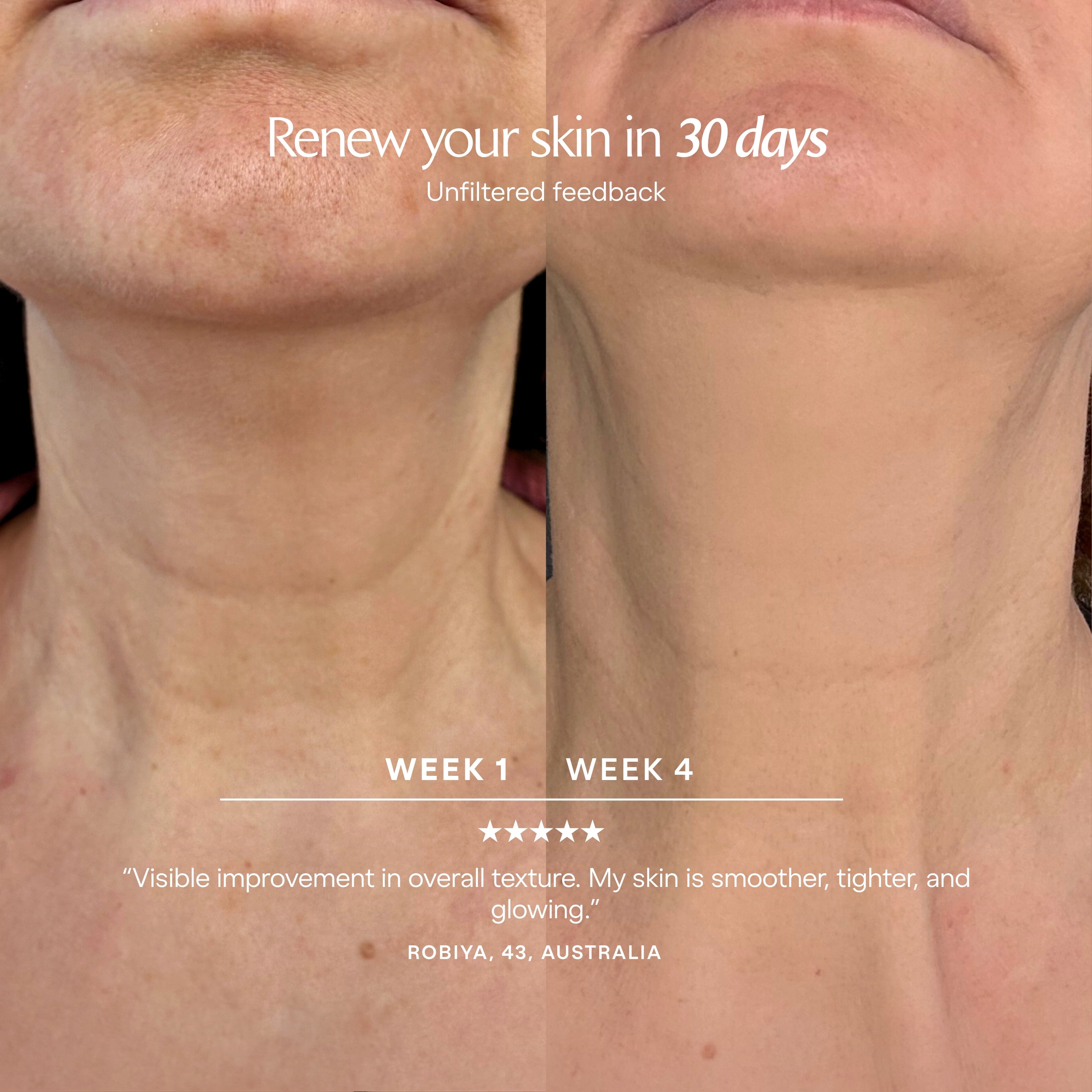 LumaLux Neck & Dec | Pro LED Red Light Therapy Mask - Project E Beauty