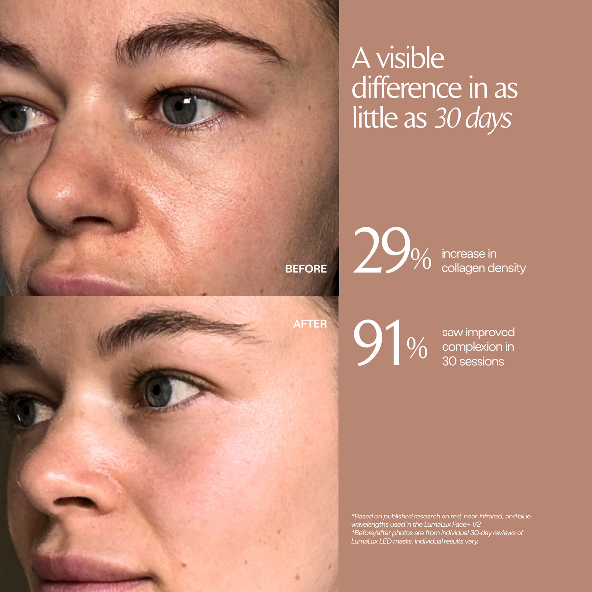 LumaLux Face+ V2 testimonial graphic with facial photographs labelled before and after, plus study percentage callouts