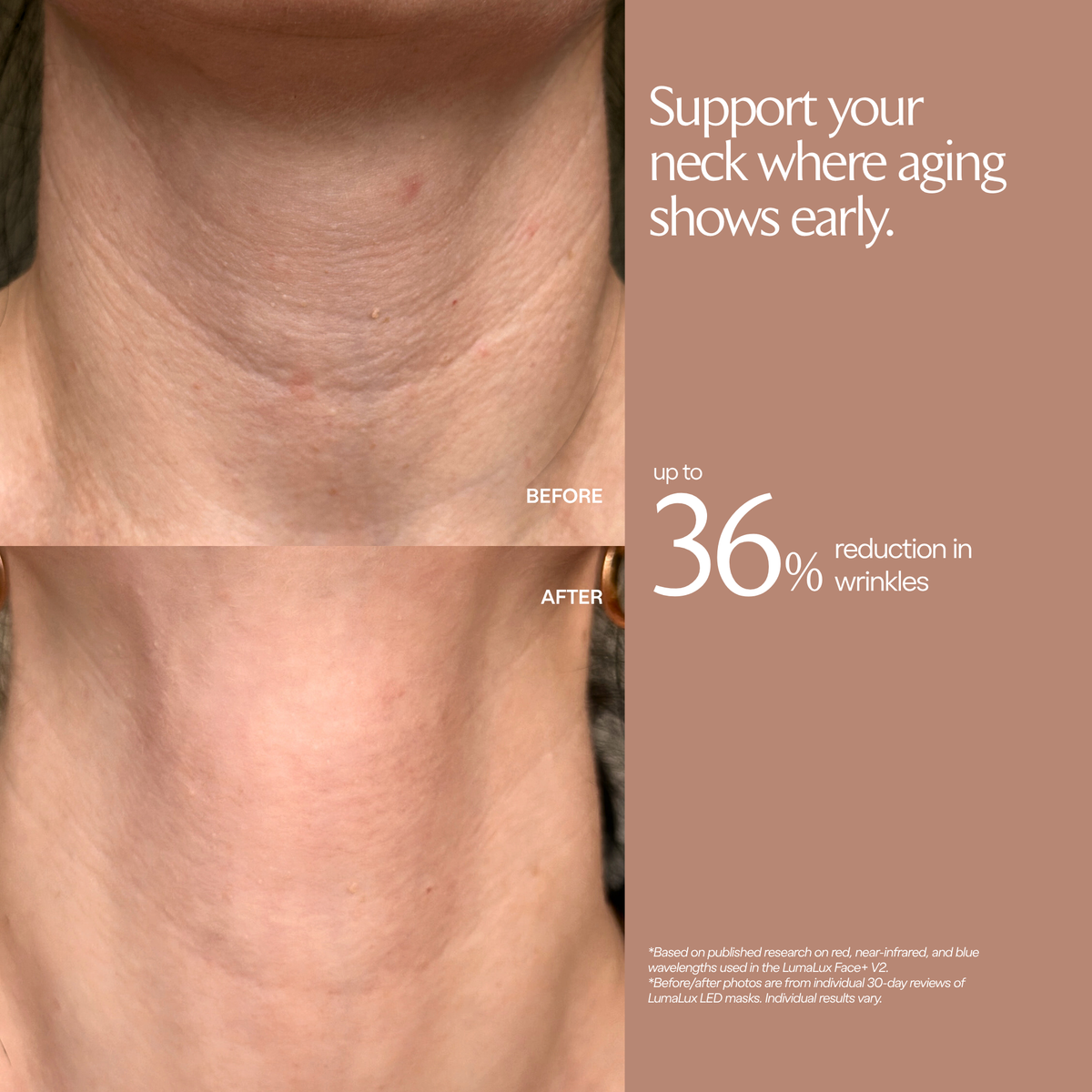 LumaLux Face+ V2 testimonial graphic with neck photographs labelled before and after and a study percentage callout