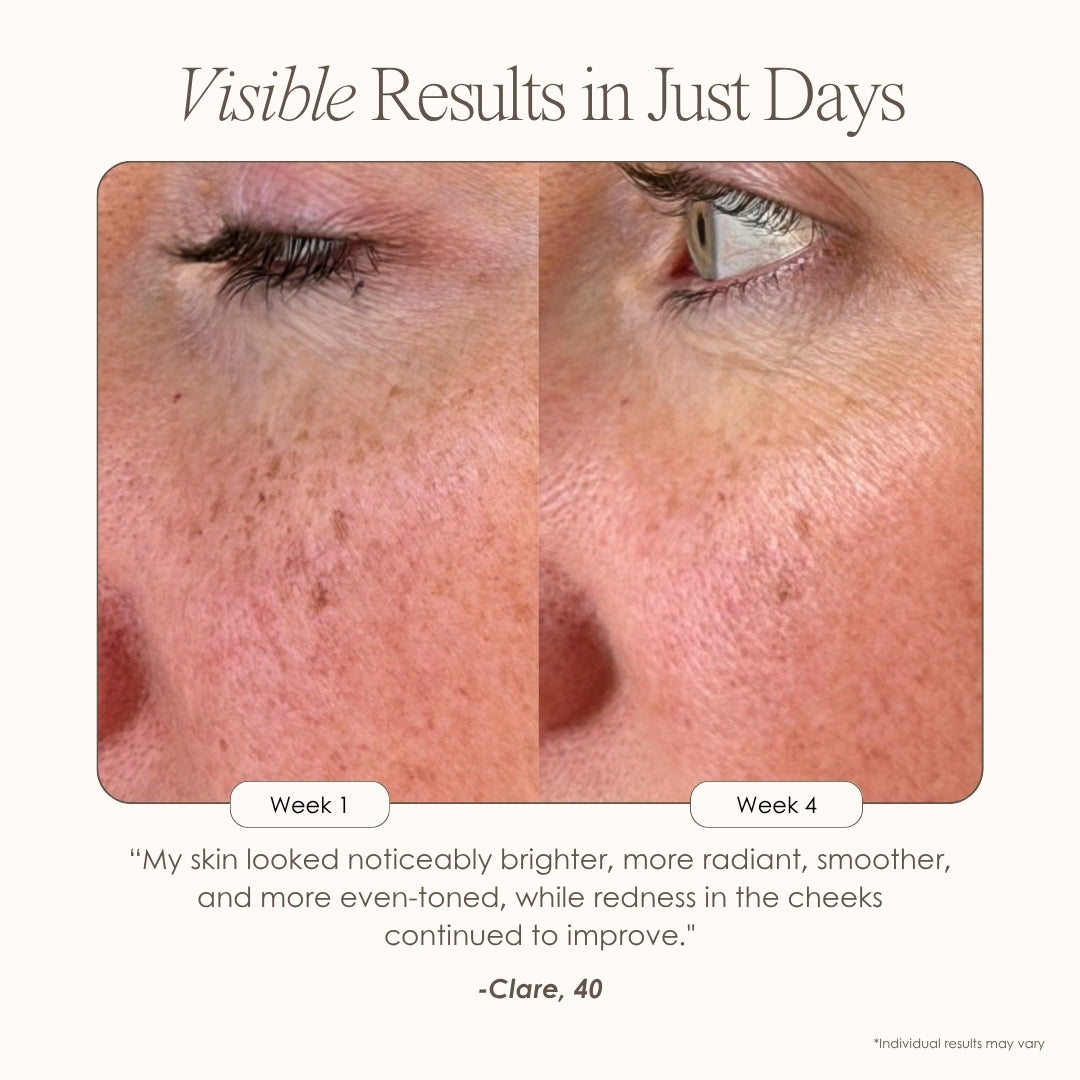 Alora | Age Renewal LED Light Therapy Panel - Project E Beauty