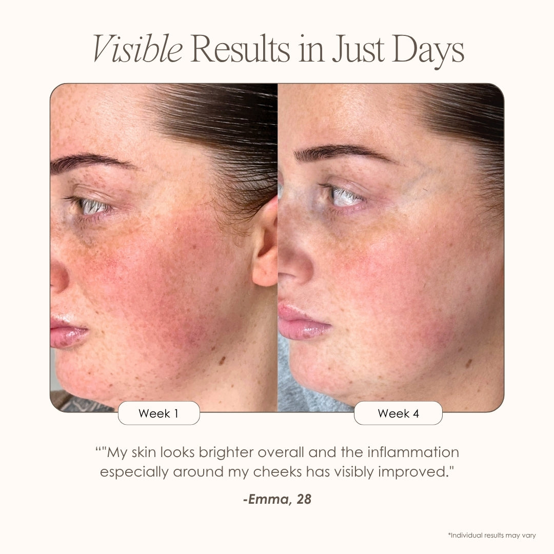 Alora | Age Renewal LED Light Therapy Panel - Project E Beauty