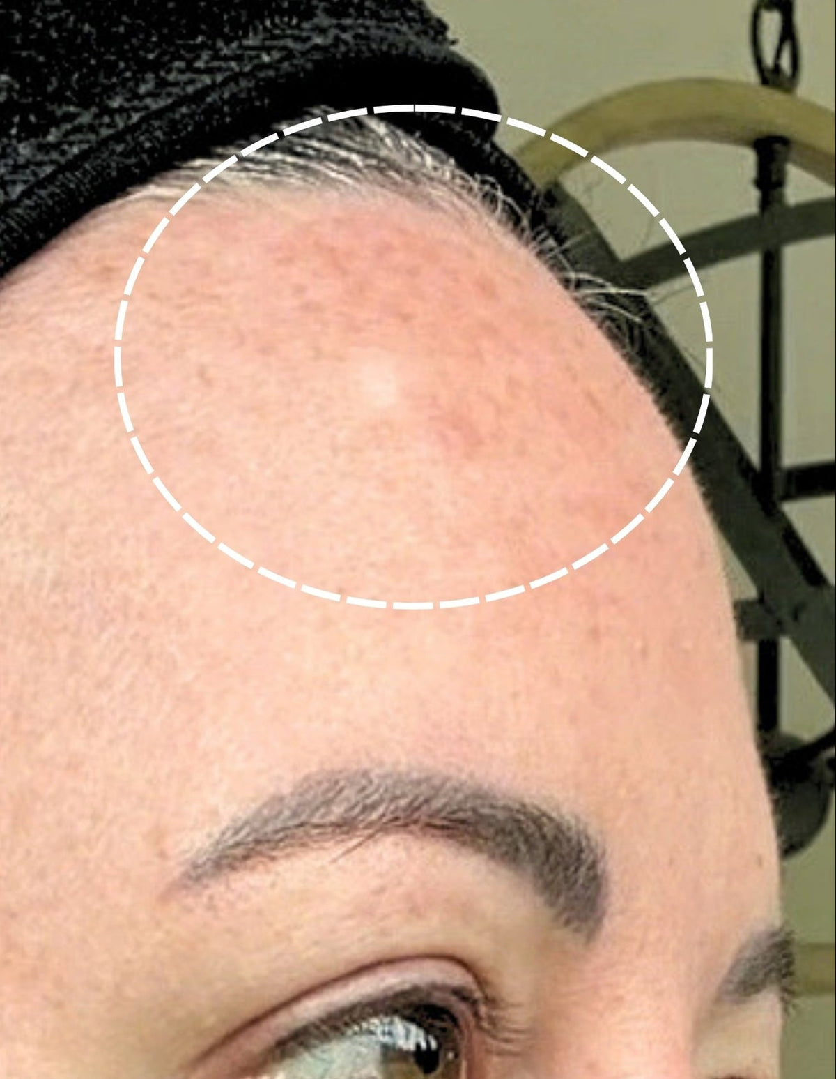Sheri after 4 weeks of LumaLux Face