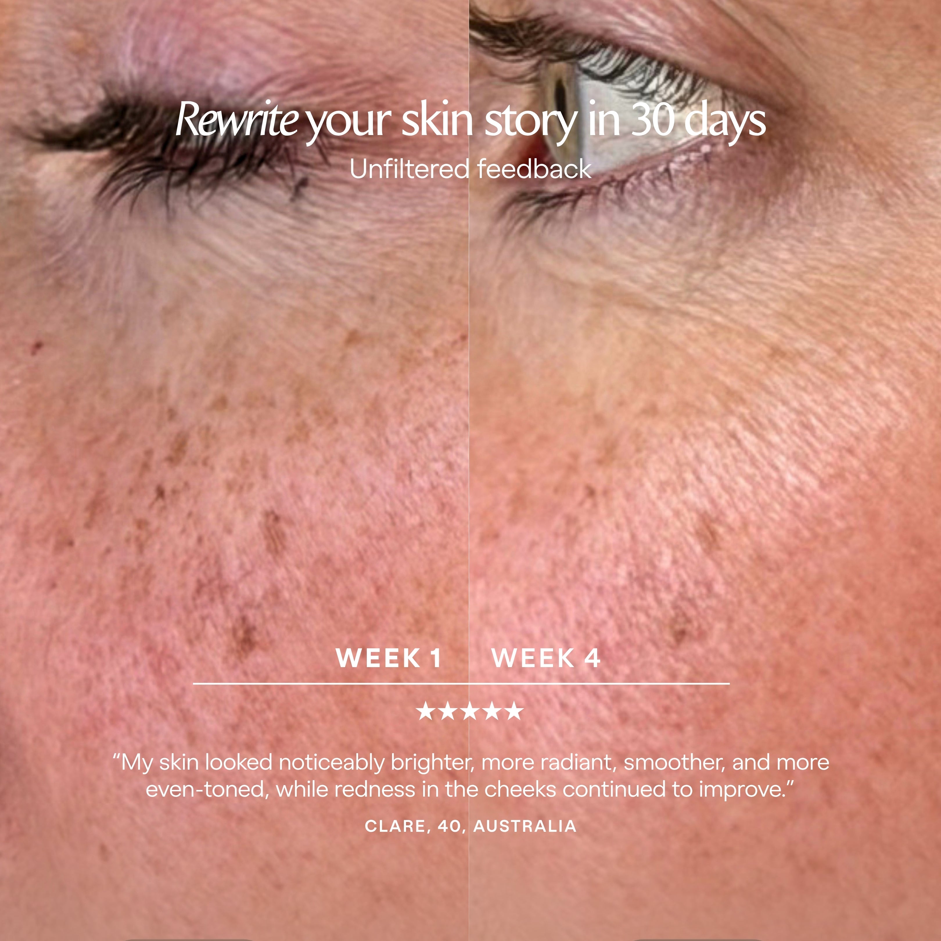 Alora | Age Renewal LED Light Therapy Panel - Project E Beauty