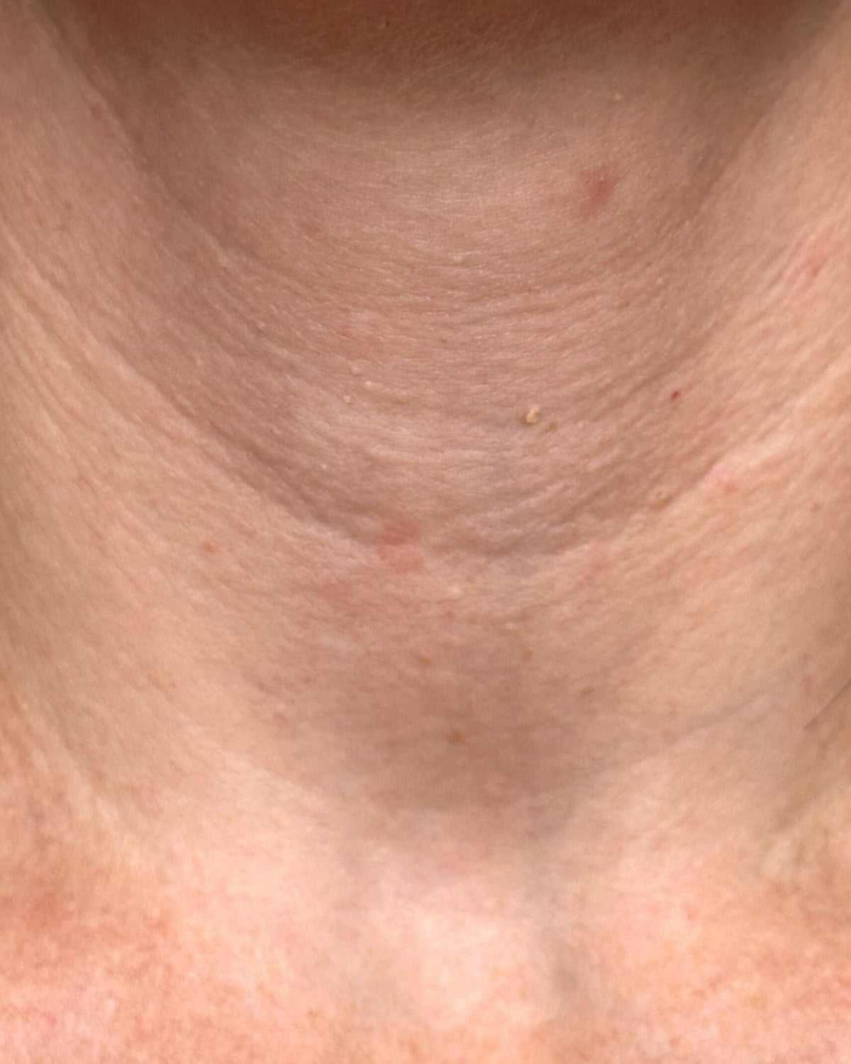 Xenia's neck before using LumaLux Face+